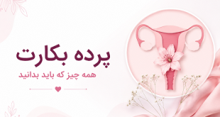پرده بکارت